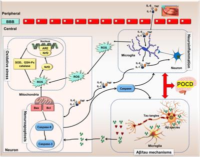 Recent progress on the role of non-coding RNA in postoperative cognitive dysfunction